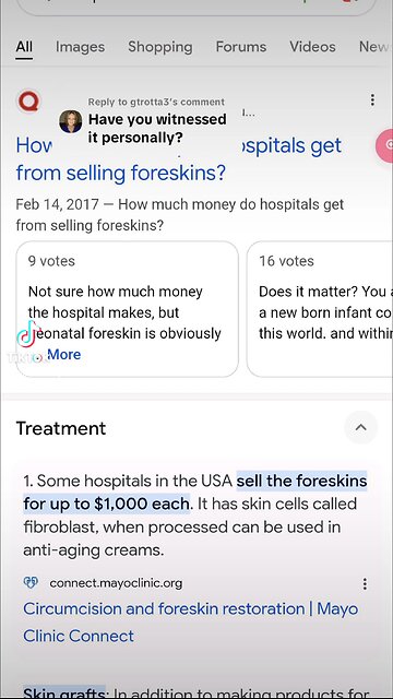 Foreskin is spendy!