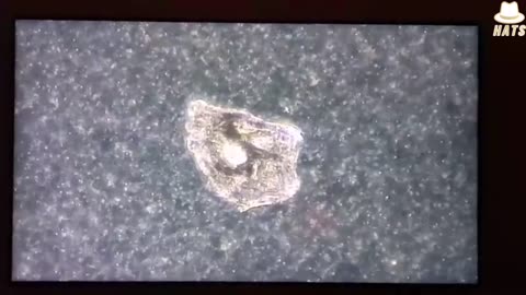 Evidence of Graphene flakes found in Convid vaccines.