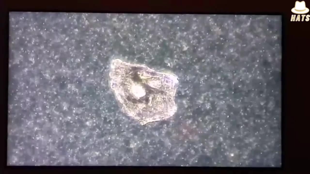 Evidence of Graphene flakes found in Convid vaccines.