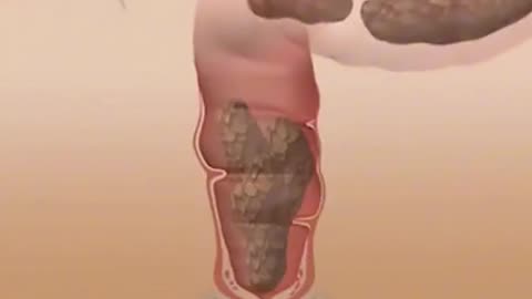 How Food Turns Into Poop (3D Animation)