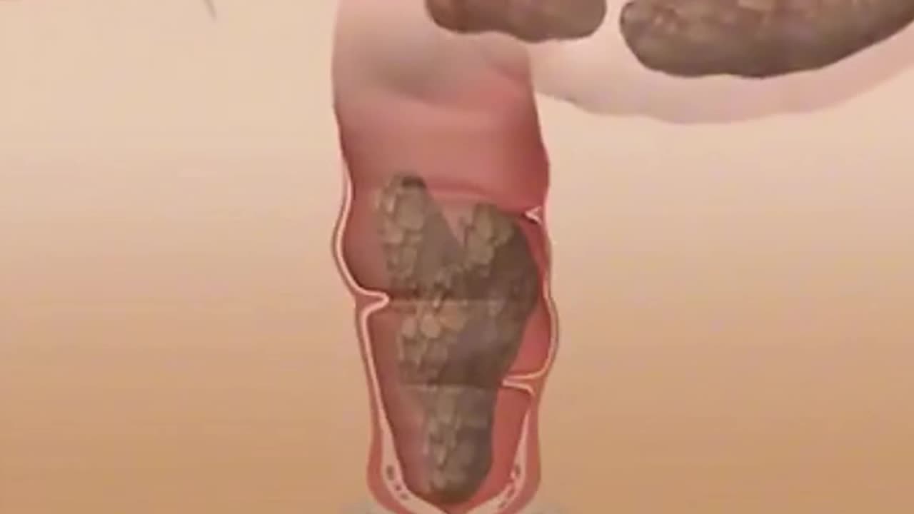 How Food Turns Into Poop (3D Animation)