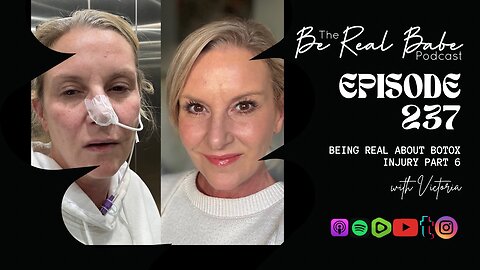 Episode 237 Being real about Botox Injury Part 6
