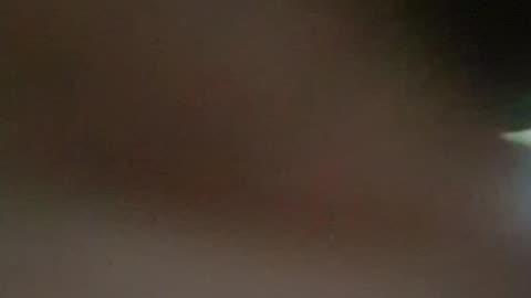 Unusual skin parasite, could this be morgellons disease?