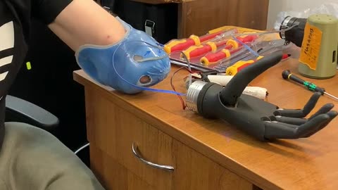 🤖🇺🇦 Ukraine Russia War | Crafting Prosthetics Amid Conflict | RCF