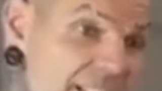 Jeff Hardy Improving After Neck Injury