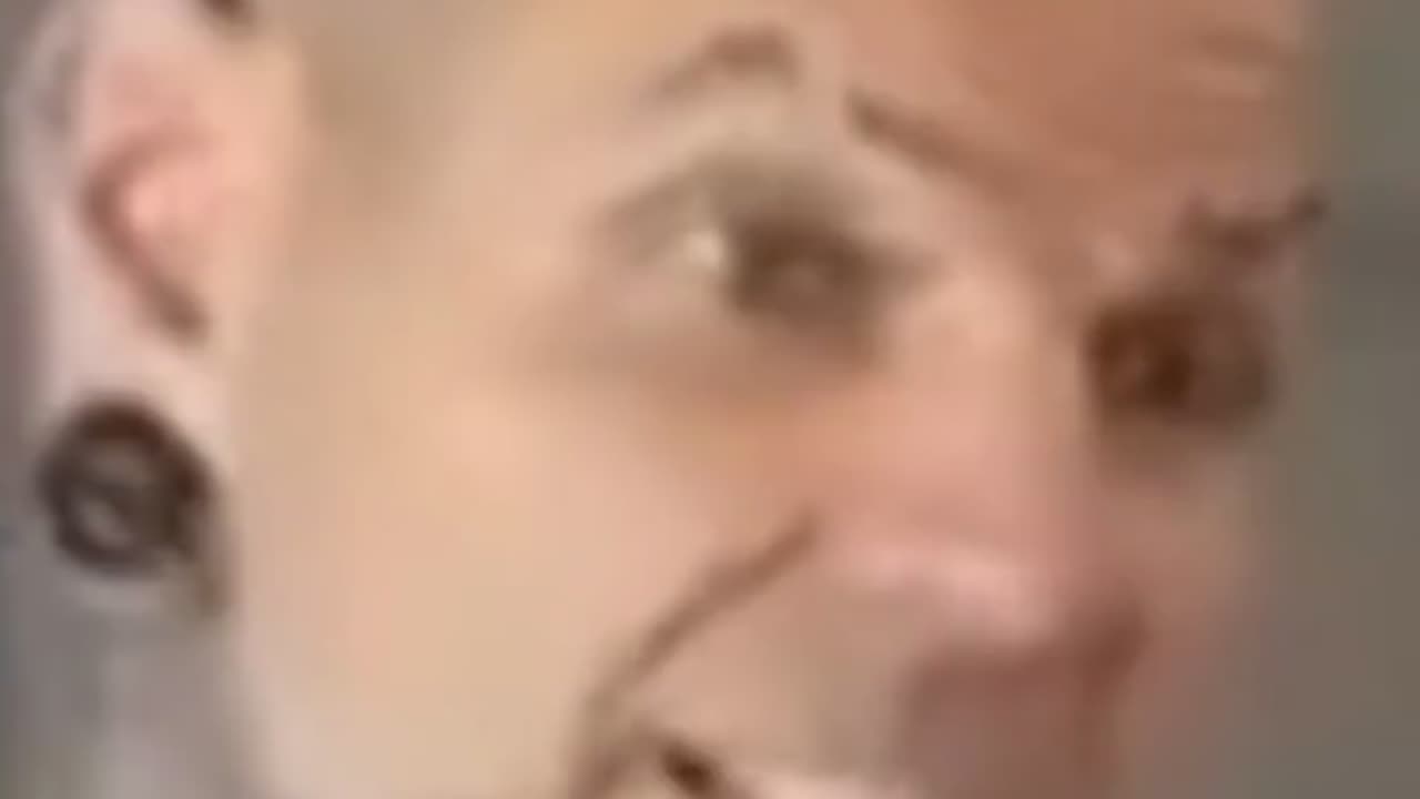 Jeff Hardy Improving After Neck Injury