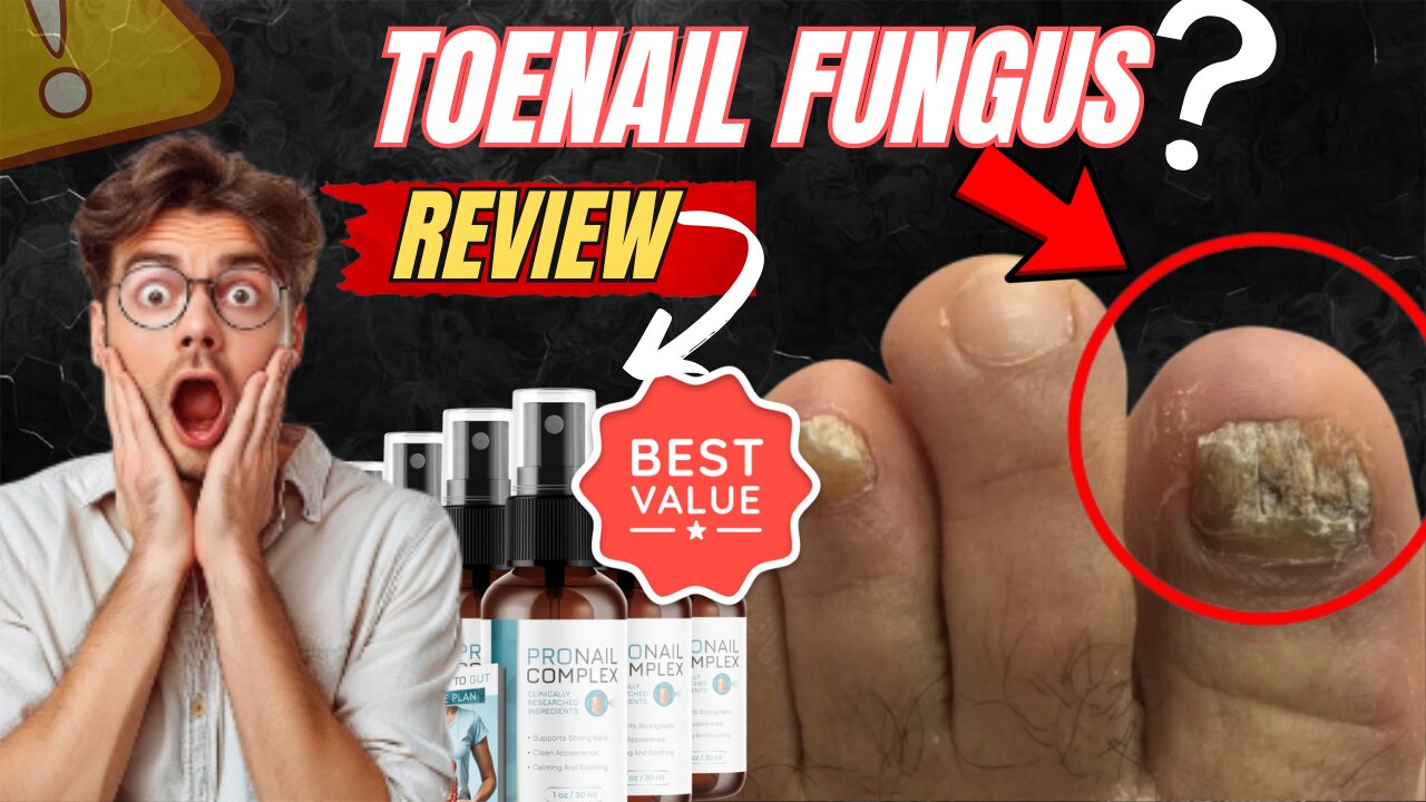 Struggling with Weak Nails or Fungus? | Pronail Complex Review | Toenail Fungus