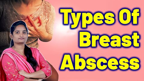 Types Of Breast Abscess | Breast Infection Homeopathy, Medicine Cure And Mammary abscess Surgery