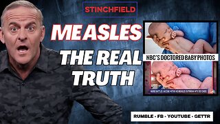 Doctored Photos and Phony Stats, How The Media is Weaponizing the Measles... Again!