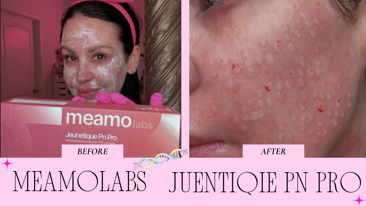 Mesotherapy Meamo Labs Juenitique PN Pro & Hyaron Target Nasolabial Folds Code: JAMIE