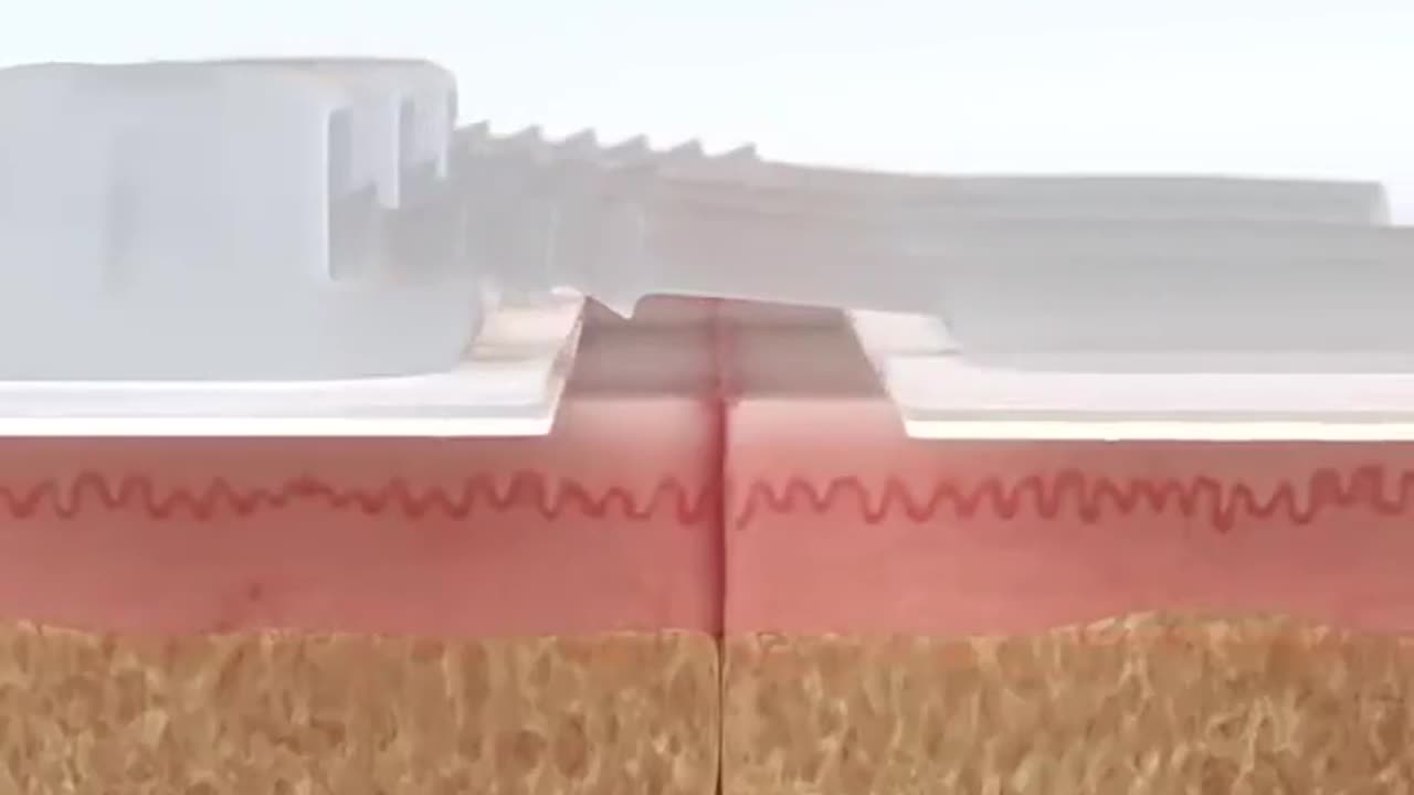 This device stitches you up