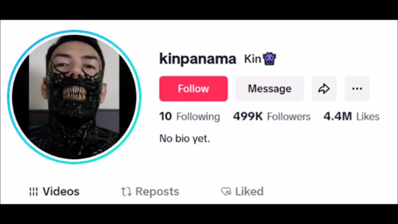 Le gars qui a l'E.T au Panama garde maintenant la créature dans un aquarium dans un endroit inconnu