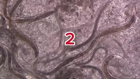 What Garlic Does to Parasites… WOW