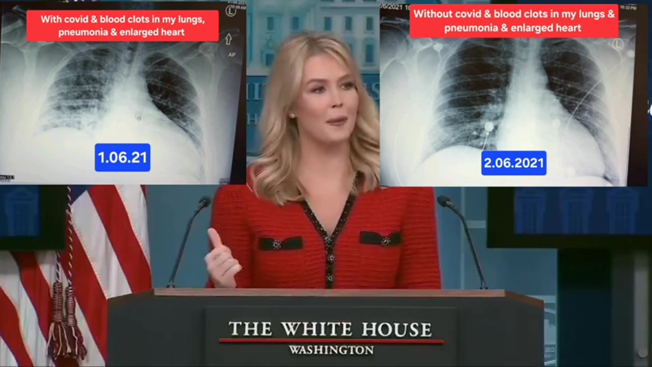 Joseph Martelli Niagara Falls, NY karoline Leavitt talking about covid