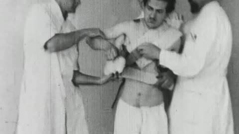 Reduction and Treatment of Fracture of the Clavicle