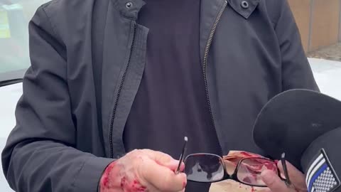 A security guard working with a news station was attacked by anti-ICE terrorists in California