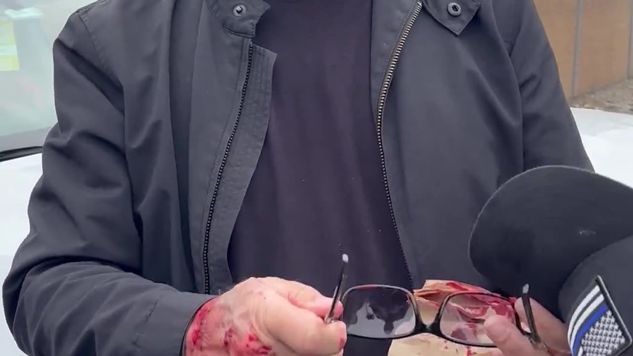 A security guard working with a news station was attacked by anti-ICE terrorists in California
