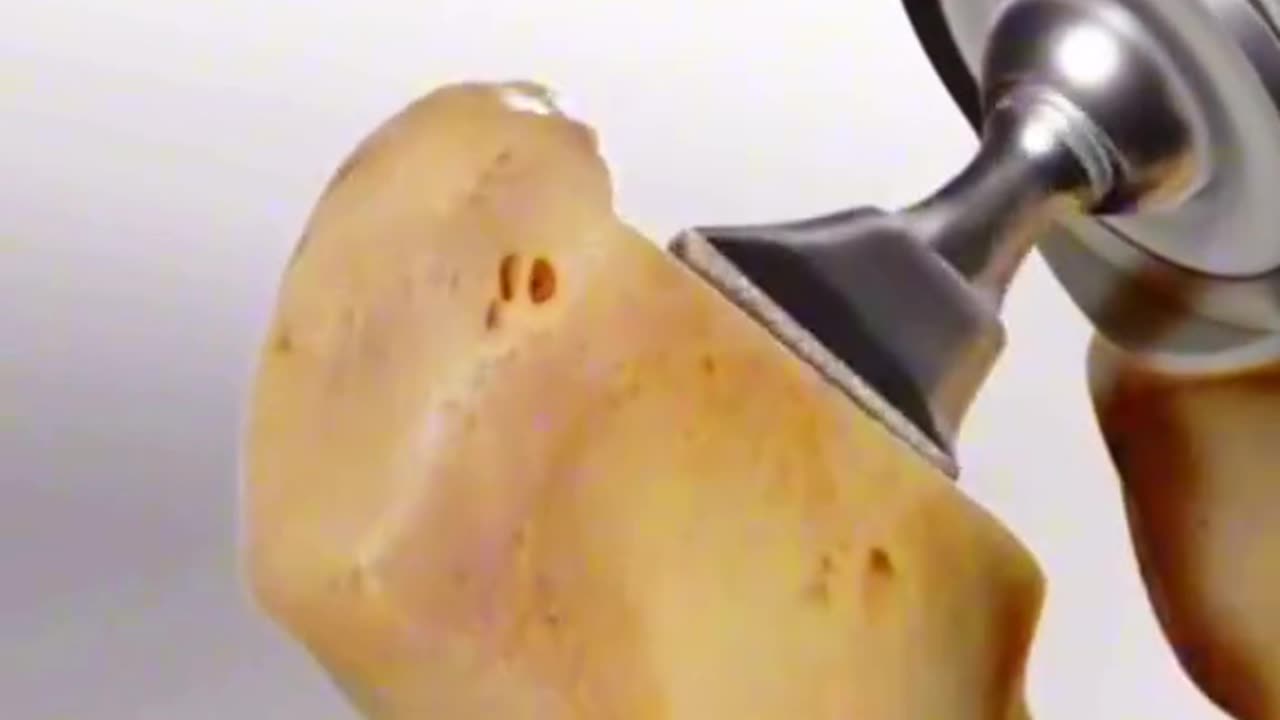 How Hip Replacement Surgery Is Performed (3D Animation)