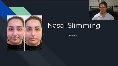 How to SHRINK your NOSE at home