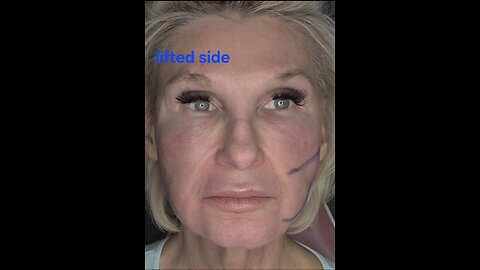 21g 90mm cog threads face lift Acecosm.com DIY55