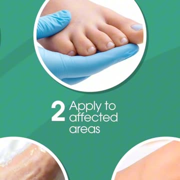 Callus Remover for Feet, Extra Strength Foot Callus Remover Gel, 8oz Salon Grade Home Pedicure