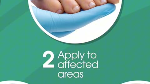 Callus Remover for Feet, Extra Strength Foot Callus Remover Gel, 8oz Salon Grade Home Pedicure