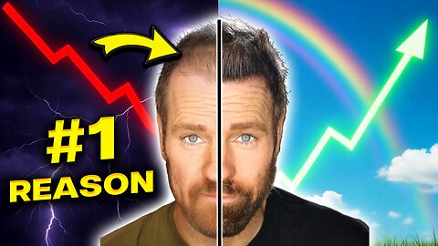 Why You’re Going Bald, DHT Explained | RU58841 Hair Loss Solution