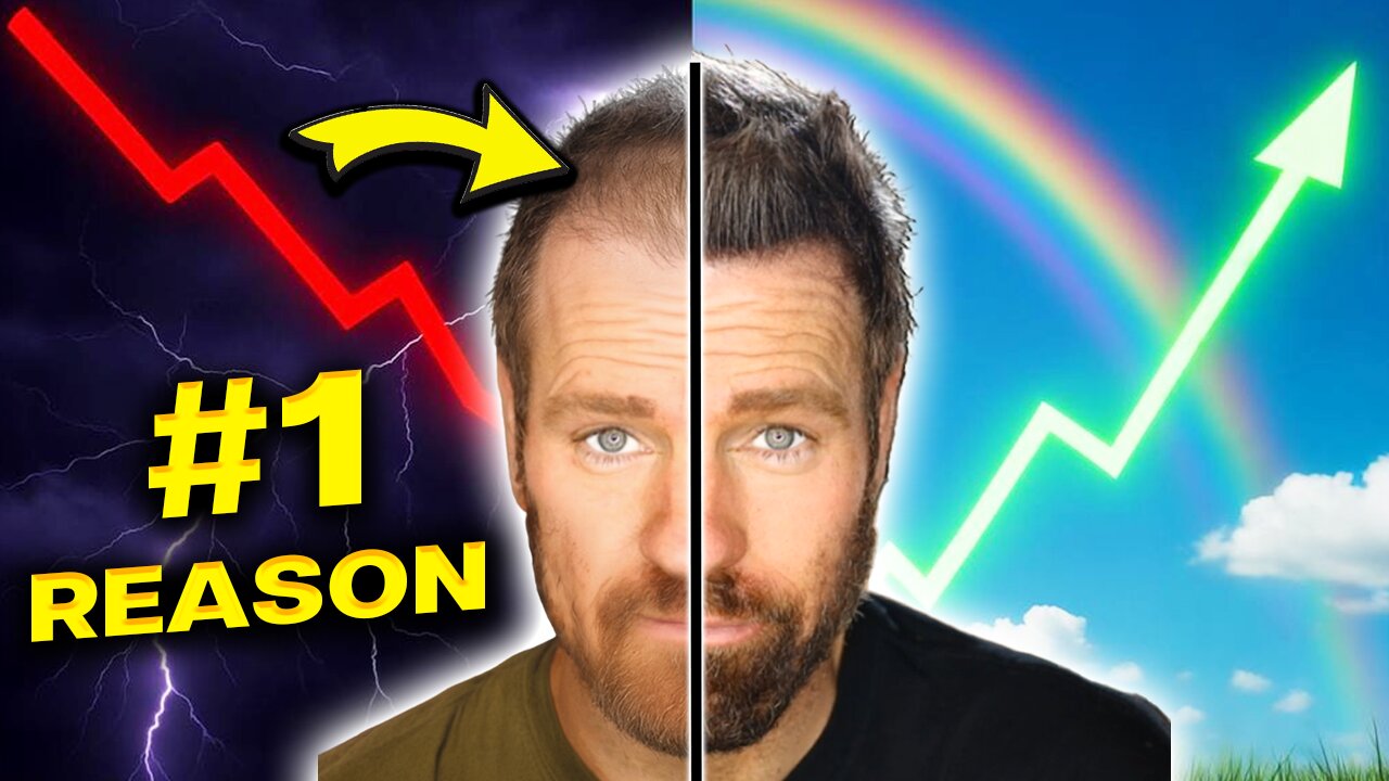 Why You’re Going Bald, DHT Explained | RU58841 Hair Loss Solution