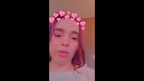 My Life Dealing With Iron Deficiency with Partial Alopecia