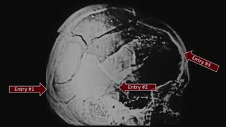 Doug Horne on the JFK Three Head Shot Scenario w/ which Drs. Chesser & Mantik Both Agree