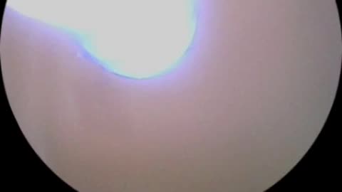 Slaying The Ear Wax Beast (December 15, 2024)