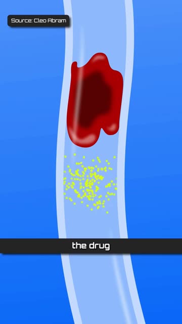 This tiny robot bead guided by magnets delivers medicine directly to its target and releases it only where it is needed