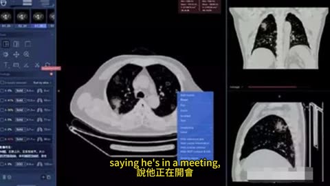 AI醫療革命 長壽市場預言