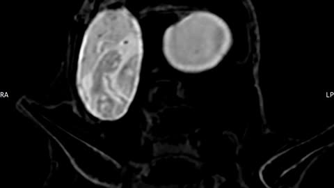 🕵️‍♂️🦆 Luisa's DICOM Files: Petrified Eggs with Babies Inside? | TheTruthAbove