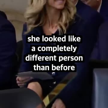 Lara Trump's plastic surgery controversy.