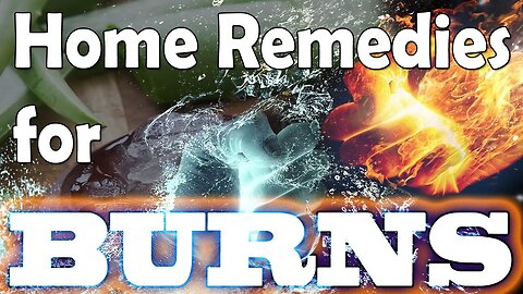 Health Video: 5 Different ways to Heal Burns