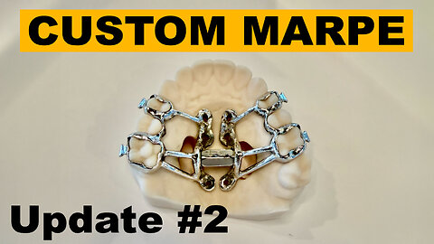 MARPE Update #2