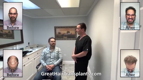 Dr. Brett Bolton Corrects Failed FUE/ARTAS Procedure for Patient Chris