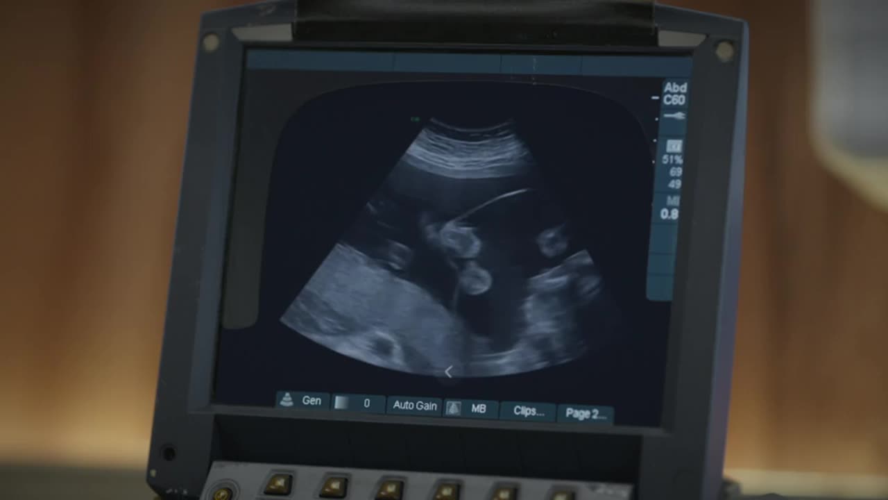 Renacer temporada 3 capitulo 12 parte 7