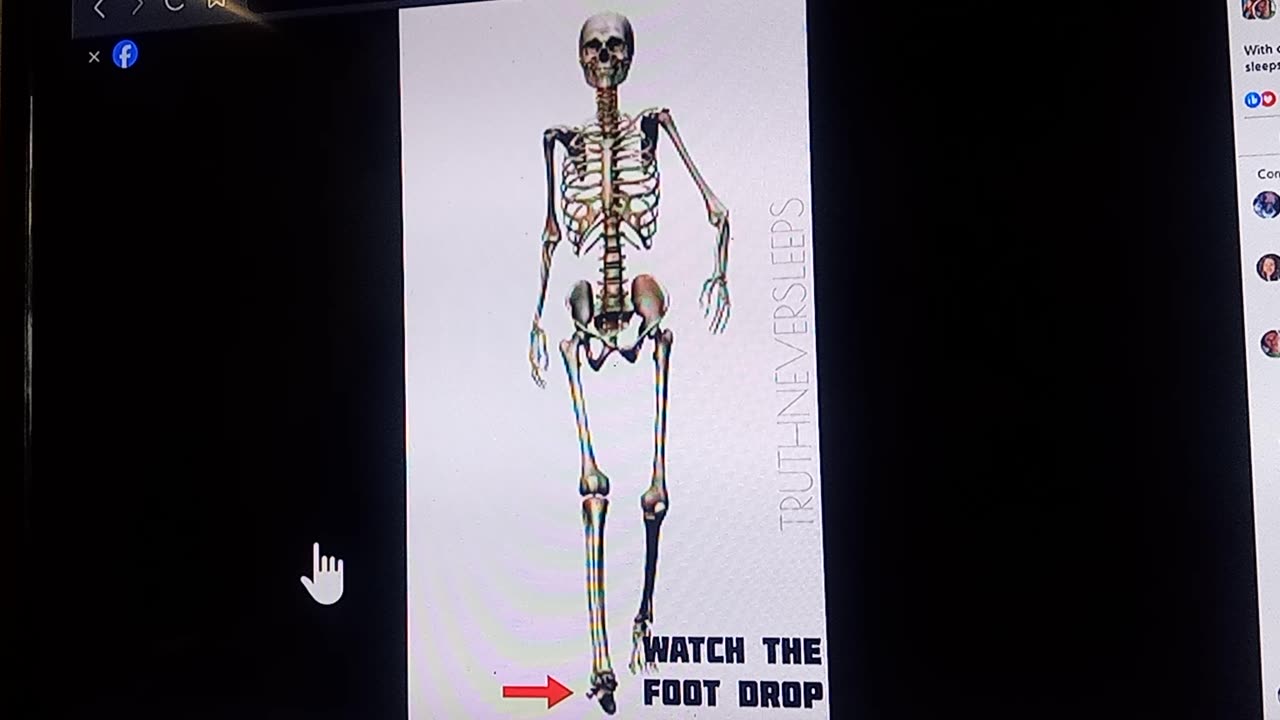 EGI Q GAIT illustrated from Your favorite uncontrollable transvestigator