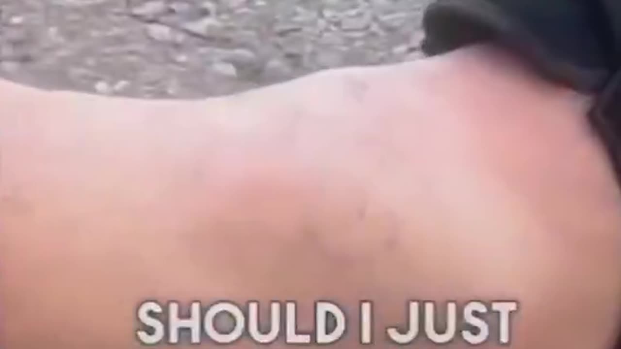 This dude wrecked his ankle skateboarding and debated going to the ER.