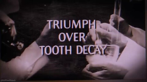 Tooth Decay