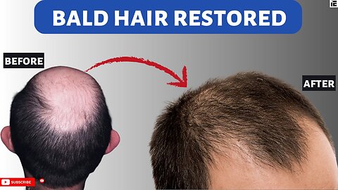 Natural Remedy for Bald Hair