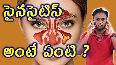 సైనసైటిస్ అంటే ఏంటి ? | What Is Sinusitis? | Nasal Sinus Infection Causes Homeopathy Treatment Cure