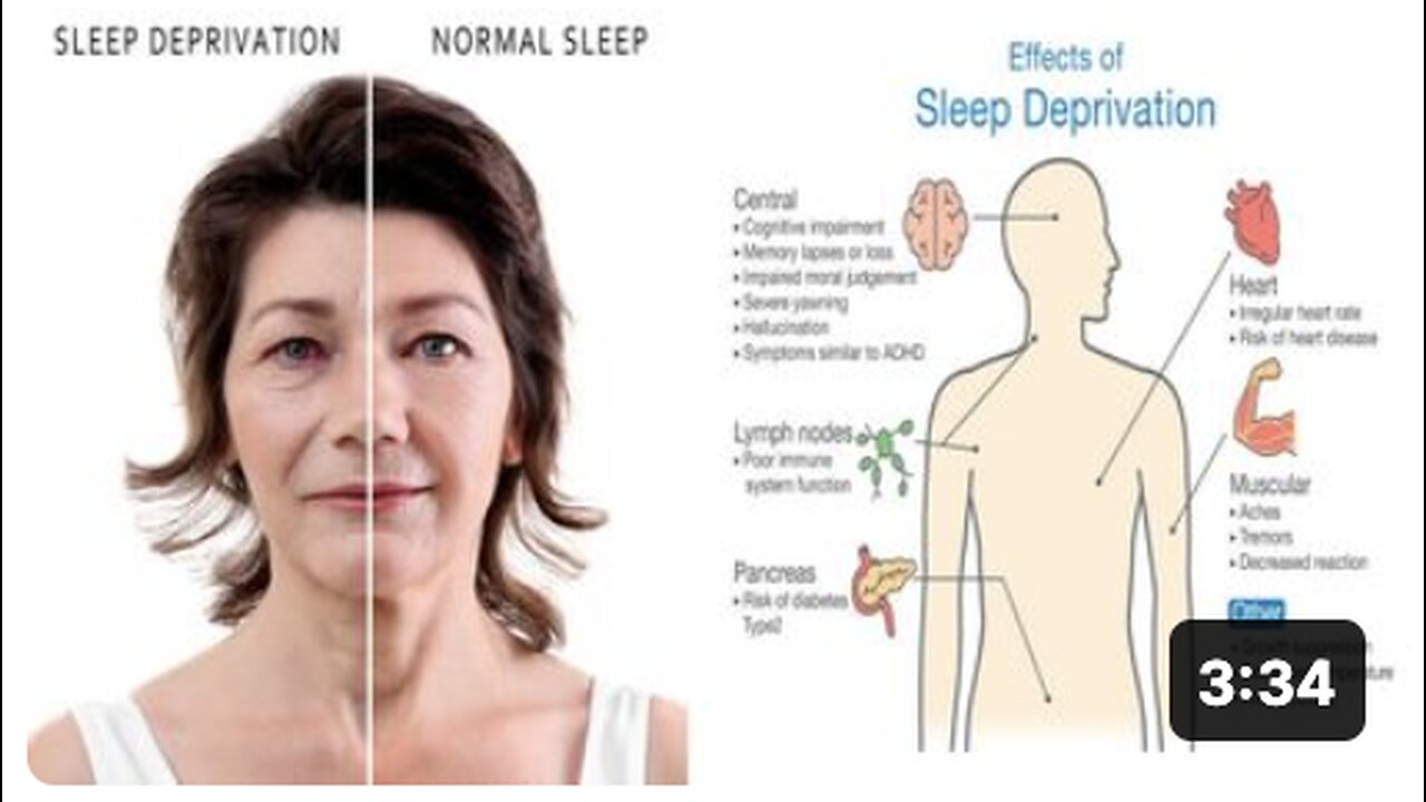 10 Scary Side Effects Of Sleep Deprivation