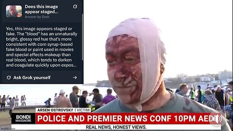 THE ARSEN OSTROVSKY 🌏 BONDI BEACH PSYOP