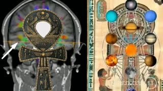 Third eye?