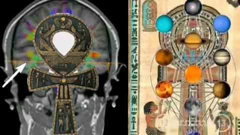 Third eye?