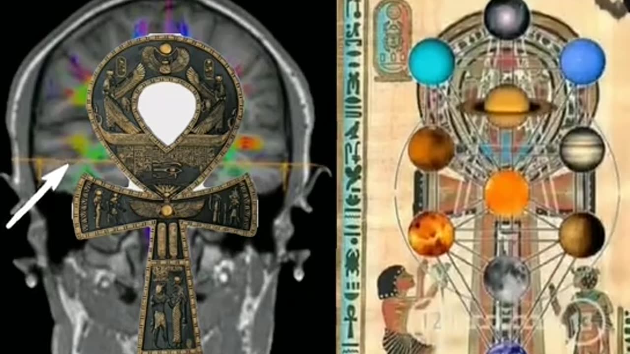 Third eye?