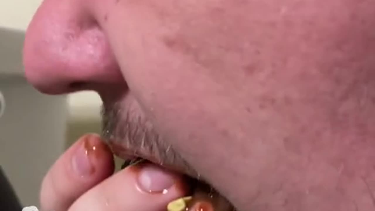 IM ADDICTED TO POOP